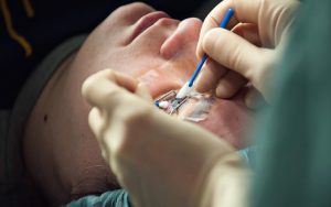 Is LASIK Eye Surgery in Shreveport Worth the Investment A Complete Cost Breakdown