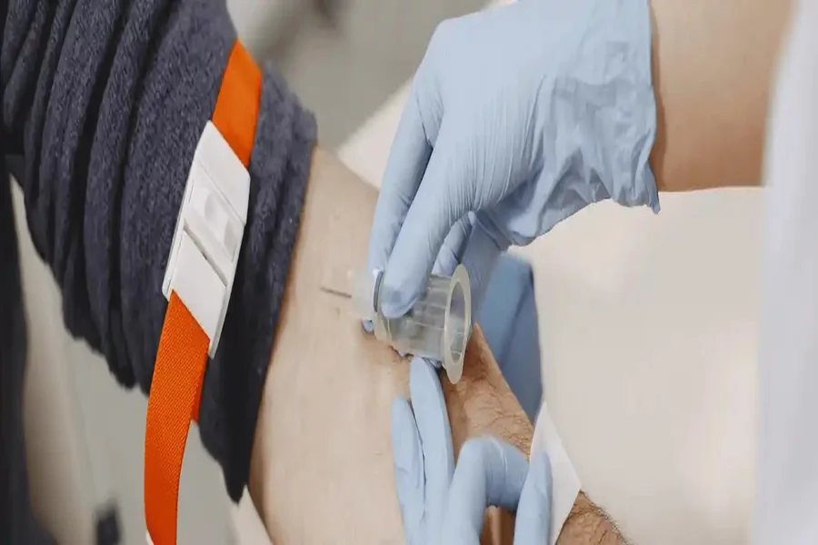 Pre-Surgical Screening