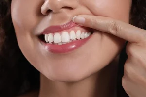 Healthier Smile