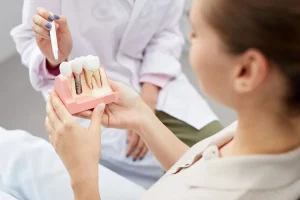Dental Implants