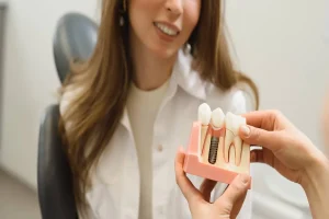 Dental Implants