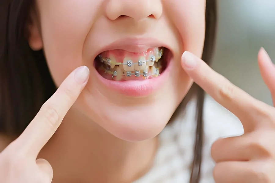 Mixed Dentition Checkups The “In Between Teeth” Visits That Matter Most